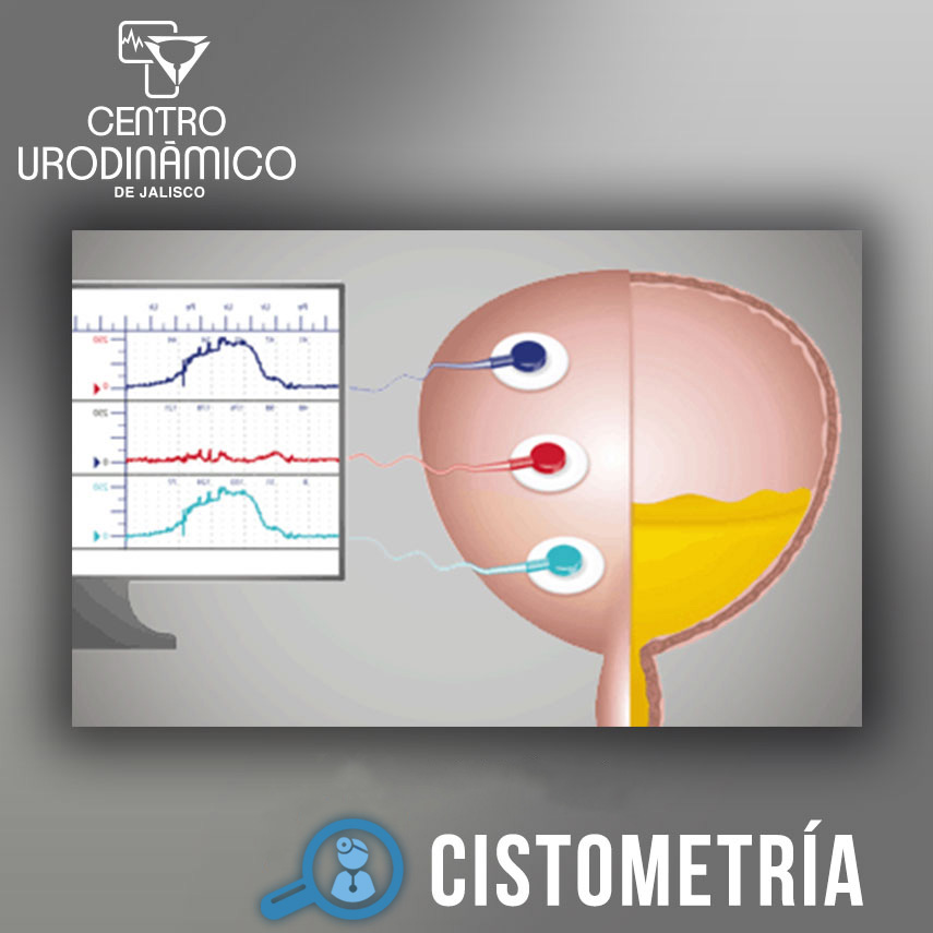 CISTOMETRÍA