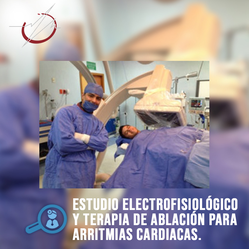 ESTUDIO ELECTROFISIOLÓGICO Y TERAPIA DE ABLACIÓN PARA ARRITMIAS CARDÍACAS