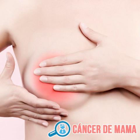 CÁNCER DE MAMA