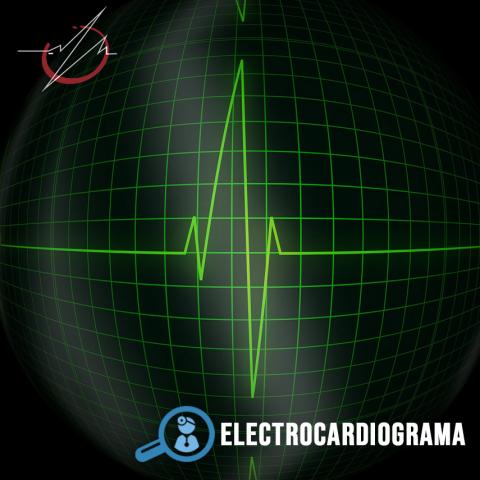 ELECTROCARDIOGRAMA