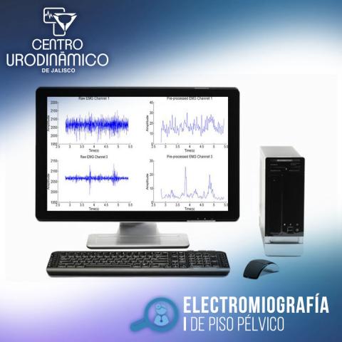 ELECTROMIOGRAFÍA DE PISO PÉLVICO