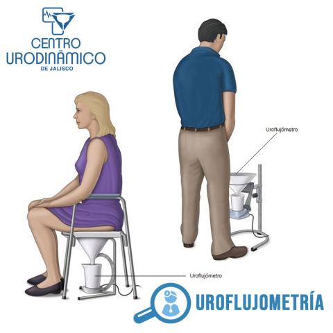 UROFLUJOMETRÍA