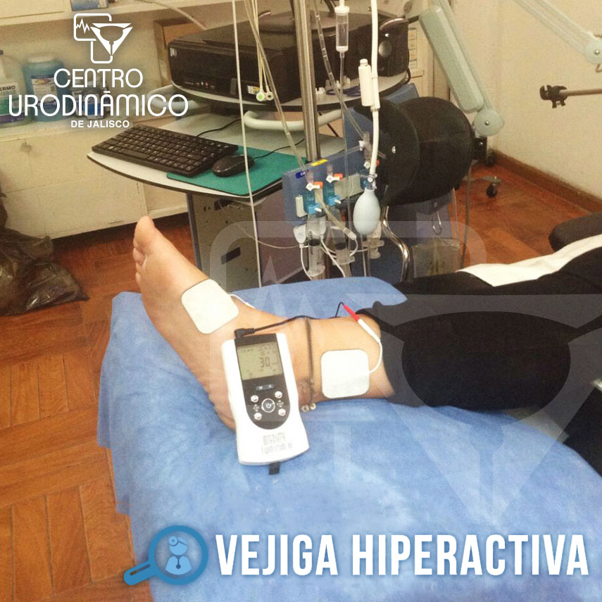 VEJIGA HIPERACTIVA